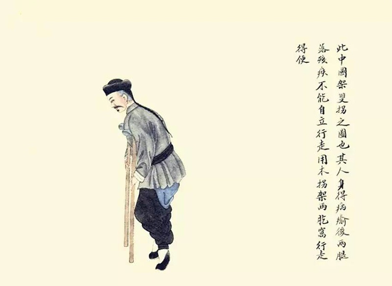 架雙拐?qǐng)D